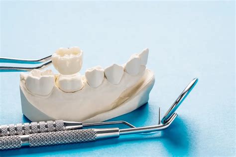 Debunking Myths About Magic Porcelain Dental Restorations